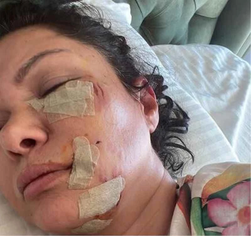 Ünlü şarkıcı Tuğba Altıntop saldırı