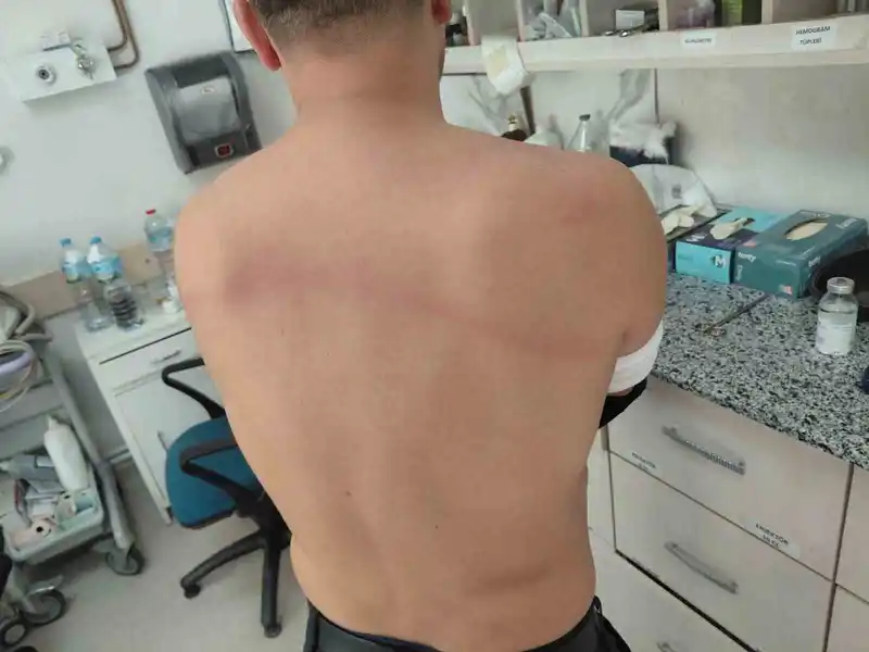 CHP’li dayakçı başkan hakkında ’Silahla kasten yaralamadan’ iddianame hazırlandı
