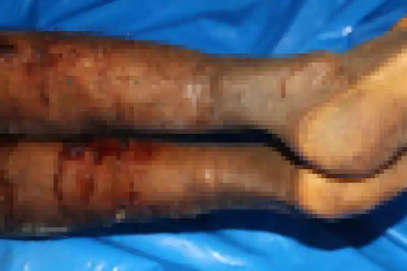 İsrail’in iade ettiği cenazelerde işkence izleri görüldü
