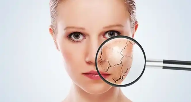 Cildiniz için kışa hazırlık reçetesi
