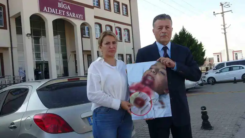 İlkokul öğrencisinin çenesi saplanan demir yüzünden koptu, ailesi okula ihmal davası açtı
