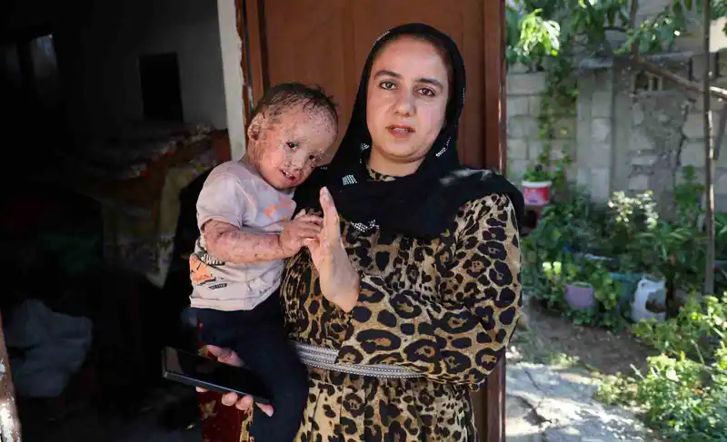 Balık pulu ve kelebek hastası Yusuf’un yardım paralarını dolandırıcılar topladı
