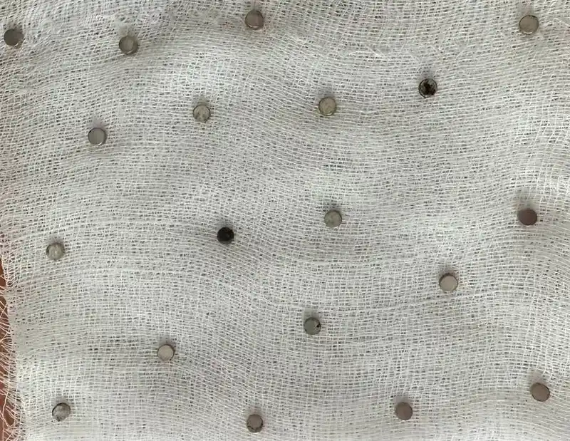 Çocuğun boğazından 19 adet mıknatıs çıkartıldı
