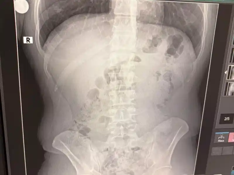 Uşak’ta midelerinden uyuşturucu çıktı: İranlı 3 kişi tutuklandı
