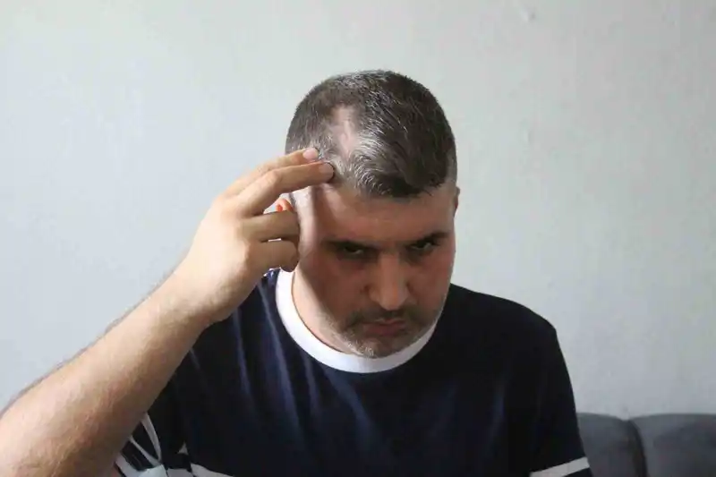 Beyzbol sopalı saldırgan dayı serbest kalınca yeğeni yardım istedi: 