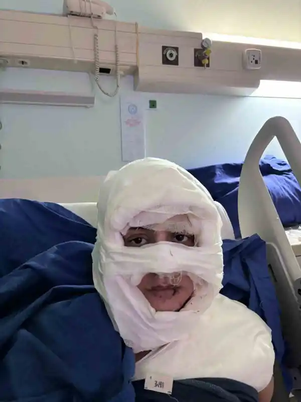 Kadıköy’de akıl almaz olay: Genç kadın başka bir kadın tarafından ateşe verildi
