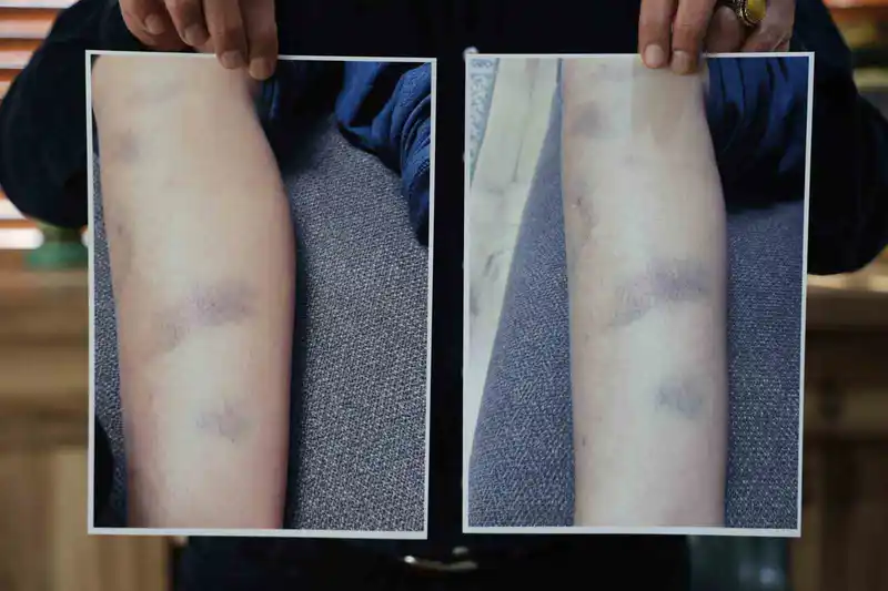 Diyarbakır’da özel okulda 8 yaşındaki çocuğun darbedildiği iddiası