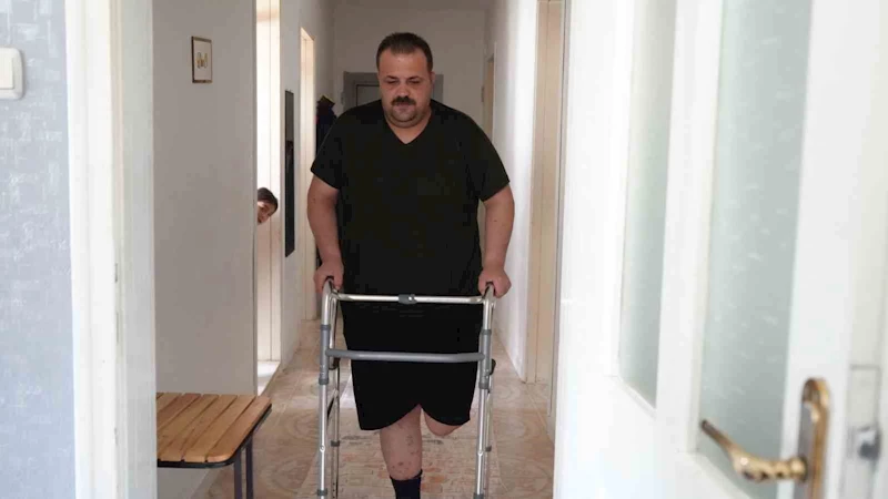 Terapi sonrası felaket: Tedavi için gitti, ayağı kesildi
