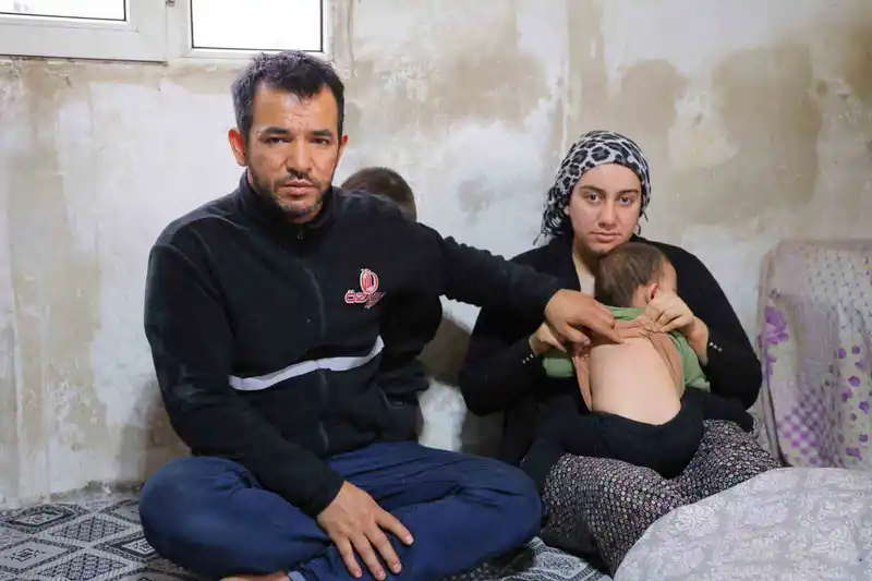 Bebeğin Belinden Çıkan Zımba Teli Aileyi Yasa Boğdu