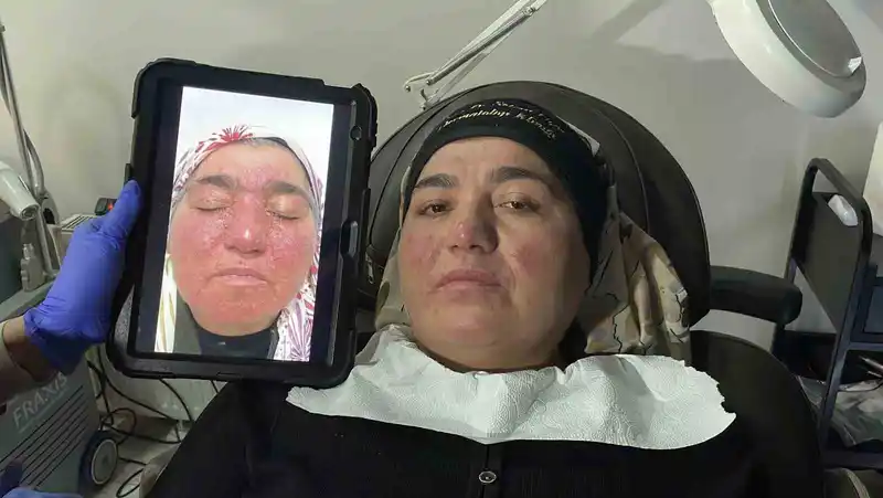 Gül hastalığından kurtulan Neriman Aksoy sosyal hayata döndü